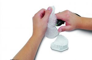 Fabrication of a retainer splint